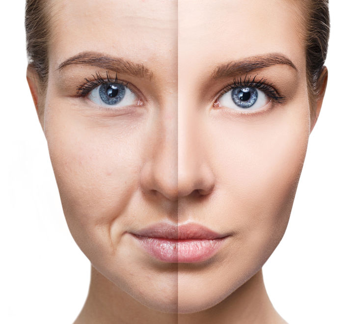 Full Face Lift - a comprehensive approach